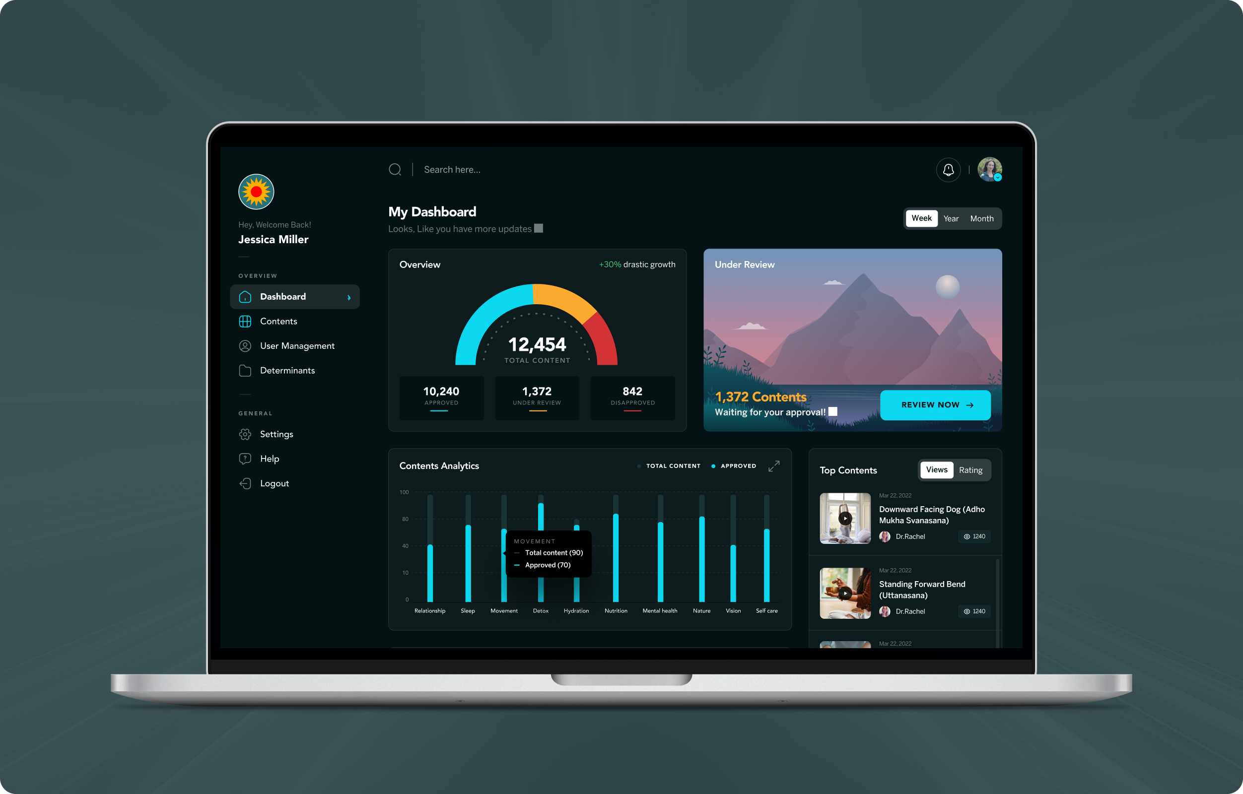 Key feature
